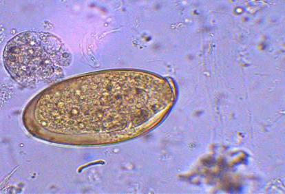 Aknu trematoda dzīves cikls. Aknu vēders: struktūra