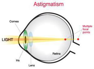 astigmatiskas kontaktlēcas