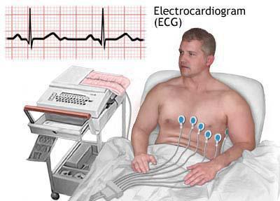 Kā lietot EKG bērnam? Kā EKG sievietēm?